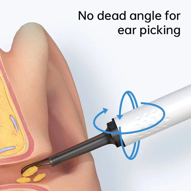 WIFI Visual Ear Cleaner Otoscope Camera